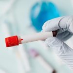 sepsis-vucudun-sessiz-firtinasi.jpg