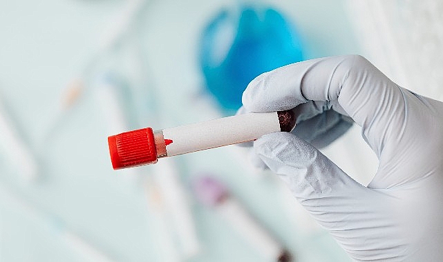sepsis-vucudun-sessiz-firtinasi.jpg