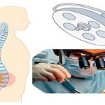 Omurga Cerrahisi ile Kim İlgilenir? Mikrocerrahi ve Sinir Cerrahisi Eğitimi Almış Uzmanların Rolü